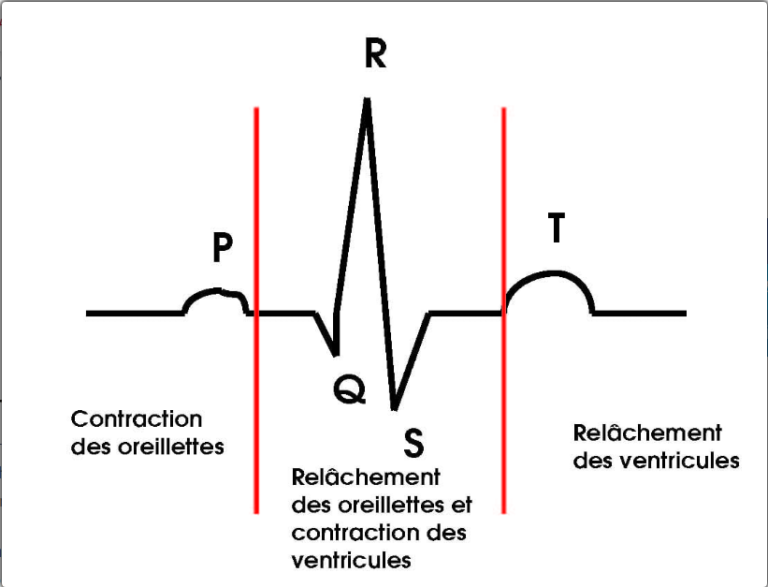 Électrocardiogramme (ECG) Centre MJ Médical Marrakech